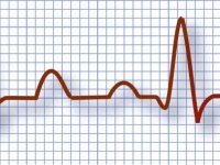 ekg-vizsgálat-Budapest